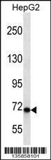 Anti-CHD1L Rabbit Polyclonal Antibody (HRP (Horseradish Peroxidase))