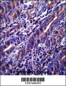 Anti-MUC1/EMA Rabbit Polyclonal Antibody (Biotin)