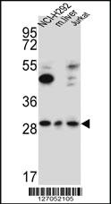 Anti-TAF1D Rabbit Polyclonal Antibody