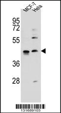 Anti-ZNF384 Rabbit Polyclonal Antibody