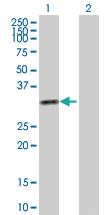 Anti-KHK Rabbit Polyclonal Antibody