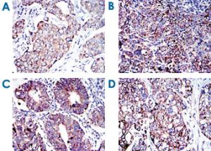 Anti-AIFM1 Mouse Monoclonal Antibody [clone: 4E7]