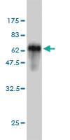 Anti-SPRY2 Mouse Monoclonal Antibody [clone: 1E10]