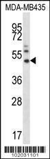 Anti-MMP16 Rabbit Polyclonal Antibody