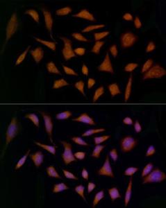 Immunofluorescence analysis of HeLa cells using Anti-Midkine Antibody (A12574) at a dilution of 1:20 (40X lens). DAPI was used to stain the cell nuclei (blue)