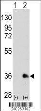 Anti-SOX2 Mouse Monoclonal Antibody [clone: 57CT23.3.4]