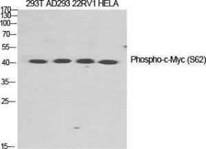 Anti-pan-myc Rabbit Polyclonal Antibody