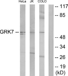 Anti-GRK7 antibody