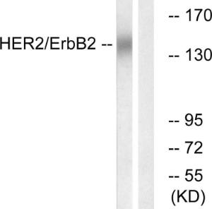 Western blot analysis of lysates from HUVEC cells using Anti-HER2 Antibody. The right hand lane represents a negative control, where the antibody is blocked by the immunising peptide