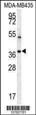 Anti-TNIP3 Rabbit Polyclonal Antibody