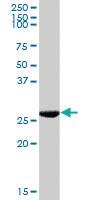 Anti-KHK Rabbit Polyclonal Antibody