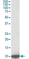 Anti-LSM2 Goat Polyclonal Antibody