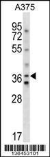 Anti-AVPR1A Rabbit Polyclonal Antibody (HRP (Horseradish Peroxidase))