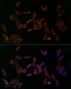 Immunofluorescence analysis of NIH/3T3 cells using Anti-Midkine Antibody (A12574) at a dilution of 1:20 (40X lens). DAPI was used to stain the cell nuclei (blue)