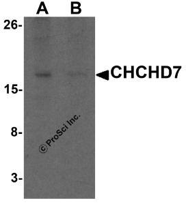 Western blot analysis of CHCHD7 in rat liver tissue lysate with CHCHD7 antibody at 1 &#956;g/mL in (A) the absence and (B) the presence of blocking peptide.