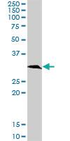 Anti-KHK Rabbit Polyclonal Antibody