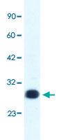 Anti-GTF2F2 Rabbit Polyclonal Antibody