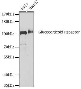 Western blot analysis of extracts of various cell lines, using Anti-Glucocorticoid Receptor Antibody (A307170) at 1:1000 dilution