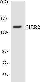 Anti-ErbB 2 Rabbit Polyclonal Antibody