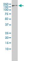 Anti-CDK13 Mouse Monoclonal Antibody [clone: 1B3-1B11]