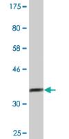 Anti-ASH2L Mouse Monoclonal Antibody [clone: 1B4]