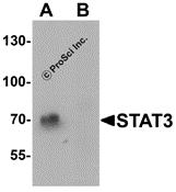 Western blot analysis of STAT3 in human small intestine tissue lysate with STAT3 antibody at 1 &#956;g/mL in (A) the absence and (B) the presence of blocking peptide.