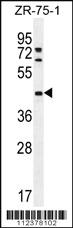 Anti-METTL2B Rabbit Polyclonal Antibody