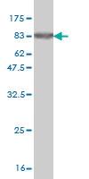 Anti-ZSCAN21 Mouse Monoclonal Antibody [clone: 4B3]