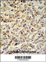 Anti-PRELP Rabbit Polyclonal Antibody (FITC (Fluorescein Isothiocyanate))