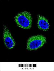 Anti-DHCR7 Rabbit Polyclonal Antibody (HRP (Horseradish Peroxidase))