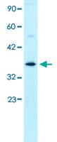 Anti-GTF2H3 Rabbit Polyclonal Antibody