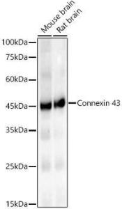 Western blot analysis of various lysates, using Anti-Connexin 43/GJA1 Antibody [ARC58819] (A309695) at 1:2,000 dilution The secondary antibody was Goat Anti-Rabbit IgG H&L Antibody (HRP) at 1:10,000 dilution Lysates/proteins were present at 25 µg per lane