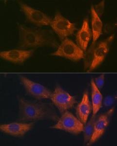 Anti-AMPK beta 1 antibody