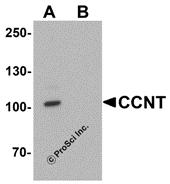 Western blot analysis of CCNT1 in rat brain tissue lysate with CCNT1 antibody at 1 &#956;g/mL in (A) the absence and (B) the presence of blocking peptide.