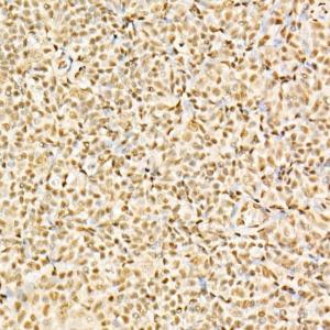 Immunohistochemistry analysis of paraffin-embedded human tonsil using Anti-Glucocorticoid Receptor Antibody (A307170) at a dilution of 1:200 (40x lens)