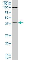 Anti-BOLL Mouse Monoclonal Antibody [clone: 5B8]