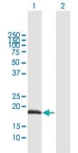 Anti-ODAM Mouse Polyclonal Antibody