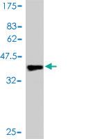 Anti-PAK1 Mouse Monoclonal Antibody [clone: 1E11]