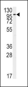 Anti-FGFR2 Rabbit Polyclonal Antibody