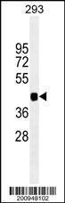 Anti-PAX6 Mouse Monoclonal Antibody (AP (Alkaline Phosphatase)) [clone: 193CT15.2.2]