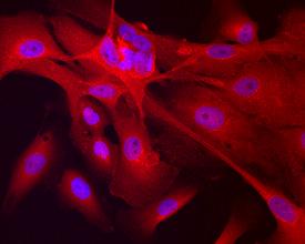 Anti-TAGLN Sheep Polyclonal Antibody