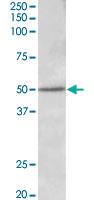 Anti-ESR2 Goat Polyclonal Antibody