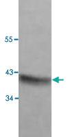 Anti-PAX2 Rabbit Polyclonal Antibody