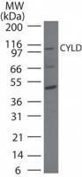 Anti-CYLD Rabbit Polyclonal Antibody