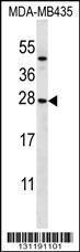 Anti-KLRC1 Rabbit Polyclonal Antibody (HRP (Horseradish Peroxidase))