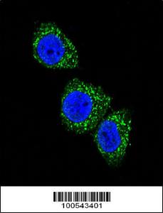 Anti-Menin Rabbit Polyclonal Antibody (HRP (Horseradish Peroxidase))