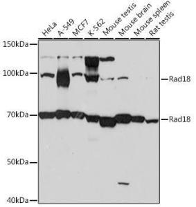 Western blot analysis of extracts of various cell lines, using Anti-RAD18 Antibody [ARC1058] (A307171) at 1:1,000 dilution. The secondary antibody was Goat Anti-Rabbit IgG H&L Antibody (HRP) at 1:10,000 dilution.