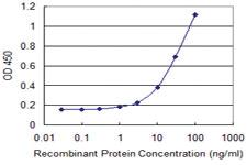 Anti-PMS2 Mouse Monoclonal Antibody [clone: 4D10]