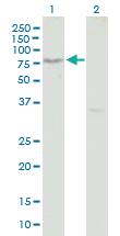 Anti-TCIRG1 Mouse Polyclonal Antibody