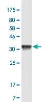 Anti-TTPA Mouse Monoclonal Antibody [clone: 7B5]